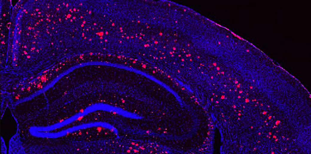 Microscope image of a light & sound treated mouse brain, cells labeled in blue, amyloid plaques in red.