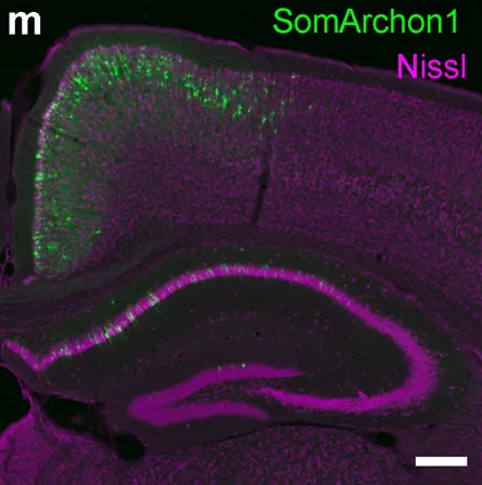 A colorfully stained image of a hippocampus